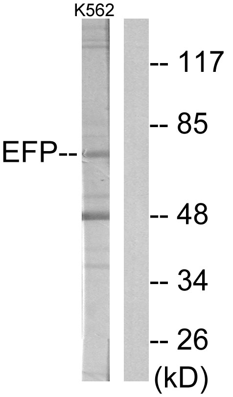 TRIM25 Antibody - Western blot analysis of lysates from K562 cells, using ZNF147 Antibody. The lane on the right is blocked with the synthesized peptide.