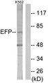 TRIM25 Antibody - Western blot analysis of lysates from K562 cells, using ZNF147 Antibody. The lane on the right is blocked with the synthesized peptide.