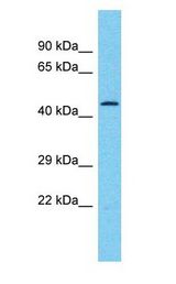 TRIM25 Antibody - TRIM25 antibody Western Blot of Breast tumor. Antibody dilution: 1 ug/ml.  This image was taken for the unconjugated form of this product. Other forms have not been tested.