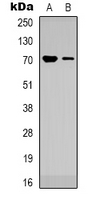 TRIM25 Antibody - Western blot analysis of TRIM25 expression in HeLa (A); K562 (B) whole cell lysates.