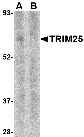 TRIM25 Antibody - Western blot of TRIM25 in human thymus tissue lysate in (A) the absence and (B) absence of blocking peptide with TRIM25 antibody at 1 ug/ml.