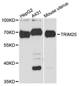 TRIM25 Antibody - Western blot analysis of extracts of various cell lines, using TRIM25 antibody at 1:3000 dilution. The secondary antibody used was an HRP Goat Anti-Rabbit IgG (H+L) at 1:10000 dilution. Lysates were loaded 25ug per lane and 3% nonfat dry milk in TBST was used for blocking. An ECL Kit was used for detection and the exposure time was 30s.