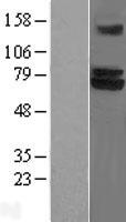TRIM25 Protein - Western validation with an anti-DDK antibody * L: Control HEK293 lysate R: Over-expression lysate