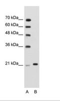 TRIM26 Antibody - A: Marker, B: Jurkat Cell Lysate.  This image was taken for the unconjugated form of this product. Other forms have not been tested.