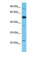 TRIM26 Antibody - Western blot of TRI26 Antibody with human Fetal Lung lysate.  This image was taken for the unconjugated form of this product. Other forms have not been tested.
