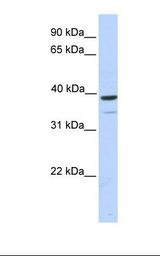 TRIM27 Antibody - Fetal muscle lysate. Antibody concentration: 1.0 ug/ml. Gel concentration: 12%.  This image was taken for the unconjugated form of this product. Other forms have not been tested.