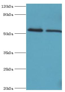 TRIM27 Antibody - Western blot. All lanes: Zinc finger protein RFP antibody at 4 ug/ml. Lane 1: Jurkat whole cell lysate. Lane 2: HepG2 whole cell lysate. Secondary antibody: Goat polyclonal to rabbit at 1:10000 dilution. Predicted band size: 58 kDa. Observed band size: 58 kDa Immunohistochemistry.