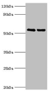 TRIM27 Antibody - Western blot All lanes: TRIM27 antibody at 4µg/ml Lane 1: Jurkat whole cell lysate Lane 2: HepG2 whole cell lysate Secondary Goat polyclonal to rabbit IgG at 1/10000 dilution Predicted band size: 59, 42 kDa Observed band size: 59 kDa