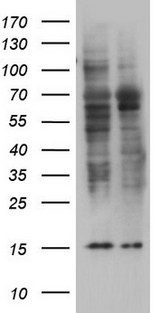 TRIM27 Antibody - HEK293T cells were transfected with the pCMV6-ENTRY control (Left lane) or pCMV6-ENTRY TRIM27 (Right lane) cDNA for 48 hrs and lysed. Equivalent amounts of cell lysates (5 ug per lane) were separated by SDS-PAGE and immunoblotted with anti-TRIM27.