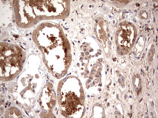 TRIM27 Antibody - IHC of paraffin-embedded Human Kidney tissue using anti-TRIM27 mouse monoclonal antibody. (Heat-induced epitope retrieval by 1 mM EDTA in 10mM Tris, pH8.5, 120°C for 3min).