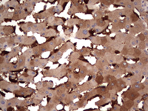 TRIM27 Antibody - IHC of paraffin-embedded Human liver tissue using anti-TRIM27 mouse monoclonal antibody. (Heat-induced epitope retrieval by 1 mM EDTA in 10mM Tris, pH8.5, 120°C for 3min).