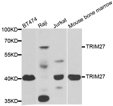 TRIM27 Antibody - Western blot analysis of extracts of various cell lines.