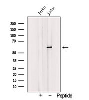 TRIM27 Antibody - Western blot analysis of extracts of COS-7 cells using TRIM27 antibody. The lane on the left was treated with blocking peptide.