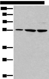 TRIM27 Antibody - Western blot analysis of 293T and A172 cell lysates  using TRIM27 Polyclonal Antibody at dilution of 1:600