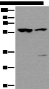 TRIM27 Antibody - Western blot analysis of Mouse testis tissue and Human testis tissue lysates  using TRIM27 Polyclonal Antibody at dilution of 1:400