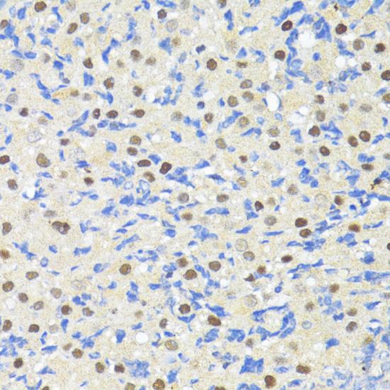 TRIM27 Antibody - Immunohistochemistry of paraffin-embedded Rat ovary using TRIM27 Polyclonal Antibody at dilution of 1:100 (40x lens).