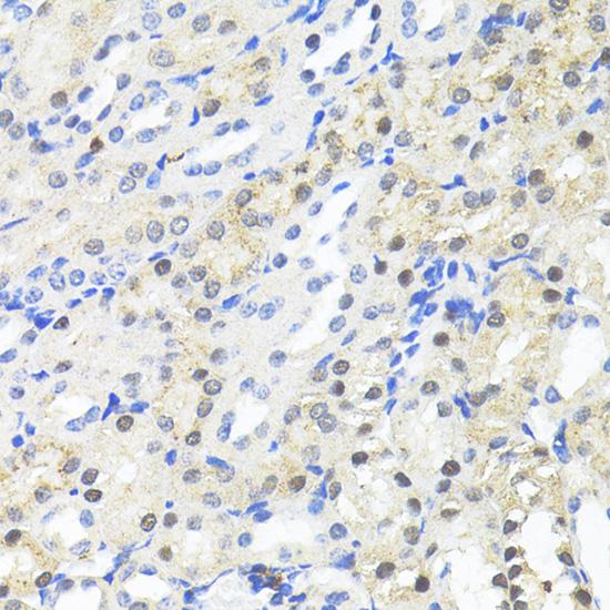 TRIM27 Antibody - Immunohistochemistry of paraffin-embedded Mouse kidney using TRIM27 Polyclonal Antibody at dilution of 1:100 (40x lens).