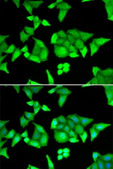 TRIM27 Antibody - Immunofluorescence analysis of U2OS cells using TRIM27 Polyclonal Antibody.