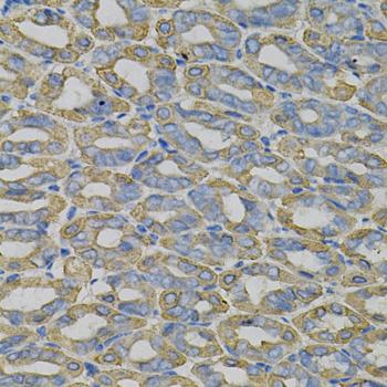 TRIM27 Antibody - Immunohistochemistry of paraffin-embedded Mouse stomach using TRIM27 Polyclonal Antibody at dilution of 1:100 (40x lens).