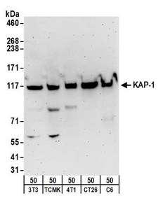 TRIM28 / KAP1 Antibody - Detection of mouse and rat KAP-1 by western blot. Samples: Whole cell lysate (50 µg) from NIH 3T3, TCMK-1, 4T1, CT26.WT, and rat C6 cells. Antibodies: Affinity purified rabbit anti-KAP-1 antibody used for WB at 1 µg/ml. Detection: Chemiluminescence with an exposure time of 3 minutes.