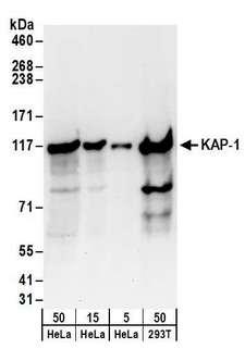 TRIM28 / KAP1 Antibody - Detection of human KAP-1 by western blot. Samples: Whole cell lysate from HeLa (5, 15 and 50 µg), and HEK293T (50µg) cells. Antibodies: Affinity purified rabbit anti-KAP-1 antibody used for WB at 0.1 µg/ml. Detection: Chemiluminescence with an exposure time of 30 seconds.