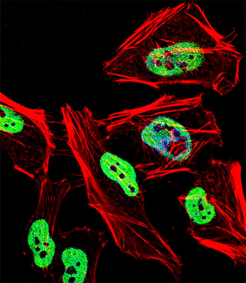 TRIM28 / KAP1 Antibody - Fluorescent confocal image of HeLa cell stained with TRIM28 Antibody. HeLa cells were fixed with 4% PFA (20 min), permeabilized with Triton X-100 (0.1%, 10 min), then incubated with TRIM28 primary antibody (1:25, 1 h at 37°C). For secondary antibody, Alexa Fluor 488 conjugated donkey anti-rabbit antibody (green) was used (1:400, 50 min at 37°C). Cytoplasmic actin was counterstained with Alexa Fluor 555 (red) conjugated Phalloidin (7units/ml, 1 h at 37°C). Nuclei were counterstained with DAPI (blue) (10 ug/ml, 10 min). TRIM28 immunoreactivity is localized to Nucleus significantly.