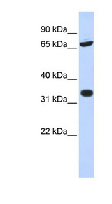 TRIM28 / KAP1 Antibody - TRIM28 antibody Western blot of HeLa lysate. This image was taken for the unconjugated form of this product. Other forms have not been tested.