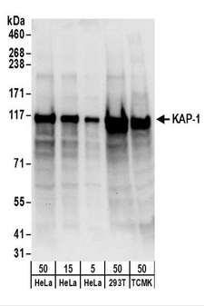 TRIM28 / KAP1 Antibody - Detection of Human and Mouse KAP-1 by Western Blot. Samples: Whole cell lysate from HeLa (5, 15 and 50 ug), 293T and mouse TCMK-1 cells. Antibodies: Affinity purified rabbit anti-KAP-1 antibody used for WB at 0.1 ug/ml. Detection: Chemiluminescence with an exposure time of 10 seconds.