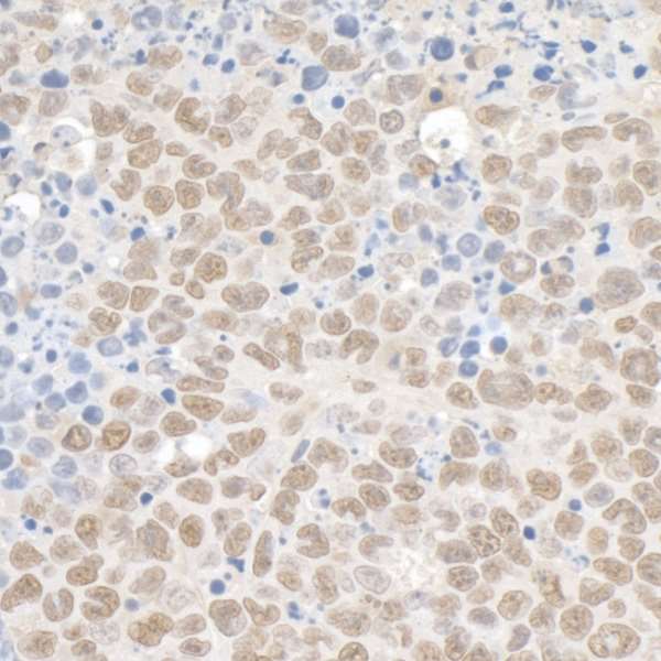 TRIM28 / KAP1 Antibody - Detection of mouse Kap-1 by immunohistochemistry. Sample: FFPE section of mouse plasmacytomaAntibody: Affinity purified rabbit anti-Kap-1 used at a dilution of 1:1,000 (1µg/ml). Detection: DAB