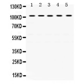 TRIM28 / KAP1 Antibody - KAP1 antibody Western blot. All lanes: Anti KAP1 at 0.5 ug/ml. Lane 1: Rat Testis Tissue Lysate at 50 ug. Lane 2: Rat Ovary Tissue Lysate at 50 ug. Lane 3: SKOV Whole Cell Lysate at 40 ug. Lane 4: COLO320 Whole Cell Lysate at 40 ug. Lane 5: HELA Whole Cell Lysate at 40 ug. Predicted band size: 105 kD. Observed band size: 105 kD.
