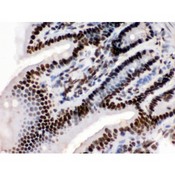 TRIM28 / KAP1 Antibody - KAP1 antibody IHC-paraffin. IHC(P): Mouse Intestine Tissue.