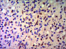 TRIM28 / KAP1 Antibody - The lack of description.
