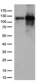 TRIM28 / KAP1 Antibody - HEK293T cells were transfected with the pCMV6-ENTRY control. (Left lane) or pCMV6-ENTRY TRIM28. (Right lane) cDNA for 48 hrs and lysed. Equivalent amounts of cell lysates. (5 ug per lane) were separated by SDS-PAGE and immunoblotted with anti-TRIM28. (1:500)