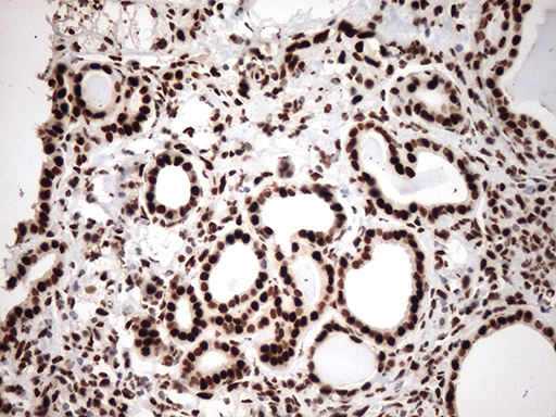 TRIM28 / KAP1 Antibody - Immunohistochemical staining of paraffin-embedded Human Kidney tissue within the normal limits using anti-TRIM28 mouse monoclonal antibody. (Heat-induced epitope retrieval by 1mM EDTA in 10mM Tris buffer. (pH8.5) at 120°C for 3 min. (1:500)