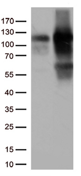 TRIM28 / KAP1 Antibody - HEK293T cells were transfected with the pCMV6-ENTRY control. (Left lane) or pCMV6-ENTRY TRIM28. (Right lane) cDNA for 48 hrs and lysed. Equivalent amounts of cell lysates. (5 ug per lane) were separated by SDS-PAGE and immunoblotted with anti-TRIM28. (1:500)