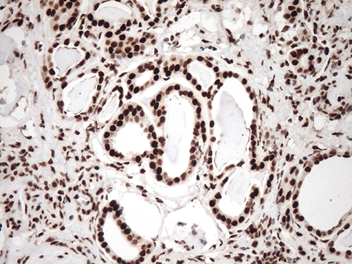 TRIM28 / KAP1 Antibody - Immunohistochemical staining of paraffin-embedded Human Kidney tissue within the normal limits using anti-TRIM28 mouse monoclonal antibody. (Heat-induced epitope retrieval by 1mM EDTA in 10mM Tris buffer. (pH8.5) at 120°C for 3 min. (1:500)