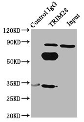 TRIM28 / KAP1 Antibody - Immunoprecipitating TRIM28 in Hela whole cell lysate Lane 1: Rabbit control IgG (1µg) instead of TRIM28 Antibody in Hela whole cell lysate.For western blotting, a HRP-conjugated Protein G antibody was used as the secondary antibody (1/2000) Lane 2: TRIM28 Antibody (6µg) + Hela whole cell lysate (500µg) Lane 3: Hela whole cell lysate (10µg)