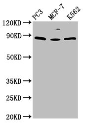 TRIM28 / KAP1 Antibody - Western Blot Positive WB detected in: PC-3 whole cell lysate, MCF-7 whole cell lysate, K562 whole cell lysate All lanes: TRIM28 antibody at 1.5µg/ml Secondary Goat polyclonal to rabbit IgG at 1/50000 dilution Predicted band size: 89, 80 kDa Observed band size: 89 kDa