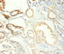 TRIM28 / KAP1 Antibody - Immunohistochemistry of paraffin-embedded human kidney tissue using TRIM28 Antibody at dilution of 1:100