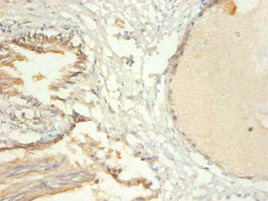 TRIM28 / KAP1 Antibody - Immunohistochemistry of paraffin-embedded human prostate tissue using TRIM28 Antibody at dilution of 1:100