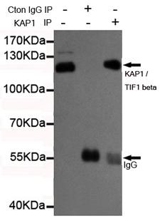 TRIM28 / KAP1 Antibody - Immunoprecipitation analysis of HeLa cell lysates using KAP1 / TIF1 beta mouse monoclonal antibody.