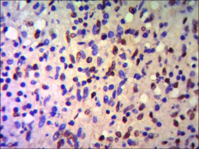 TRIM28 / KAP1 Antibody - IHC of paraffin-embedded human Spleen using anti-KAP1 / TIF1 beta diluted 1/500-1/1000.