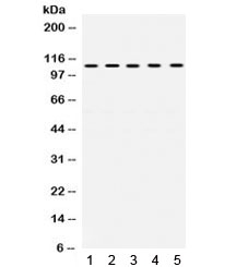TRIM28 / KAP1 Antibody