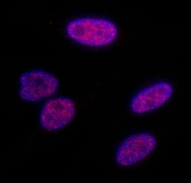 TRIM28 / KAP1 Antibody - Detection of Human Phospho KAP-1 (S824) by Immunocytochemistry. Samples: NBF-fixed, asynchronous HeLa cells. Antibody: Affinity purified rabbit anti-Phospho KAP-1 (S824) used at a dilution of 1:200 (1 ug/ml). Detection: Red fluorescent Anti-rabbit IgG-DyLight 594 conjugated used at a dilution of 1:100.