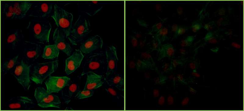 TRIM28 / KAP1 Antibody - Detection of human Phospho KAP-1 (S824) by immunocytochemistry. Samples: NBF-fixed asynchronous HeLa cells grown in chambered microscope slides and treated with etoposide (left) or untreated (right). Antibody: Affinity purified rabbit anti-Phospho KAP-1 (S824) used at a dilution of 1:200 (1µg/ml). Detection: Red fluorescent Anti-rabbit IgG-DyLight® 594 conjugated used at a dilution of 1:100.