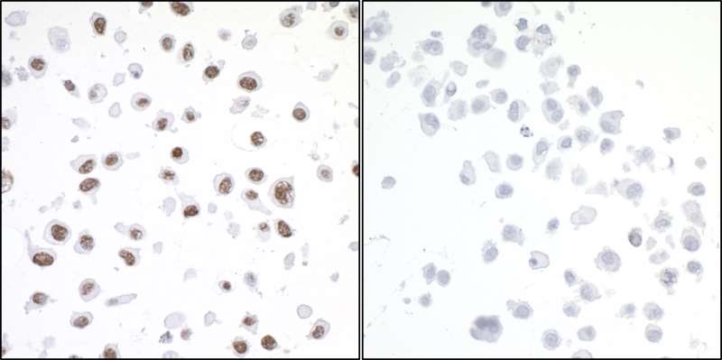 TRIM28 / KAP1 Antibody - Detection of human Phospho KAP-1 (S824) by immunocytochemistry. Samples: FFPE serial sections of asynchronous HeLa cells treated with etoposide (left) and untreated HeLa cells (right). Antibody: Affinity purified rabbit anti-Phospho KAP-1 (S824) used at a dilution of 1:200 (1µg/ml). Detection: DAB