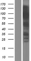 TRIM28 / KAP1 Protein - Western validation with an anti-DDK antibody * L: Control HEK293 lysate R: Over-expression lysate
