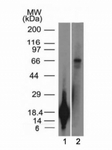 TRIM29 Antibody - Western blot testing of a 1) partial recombinant protein and 2) A431 cell lysate using TRIM29 antibody (TRIM29/1042).  This image was taken for the unmodified form of this product. Other forms have not been tested.