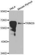 TRIM29 Antibody - Western blot analysis of extracts of various cell lines.