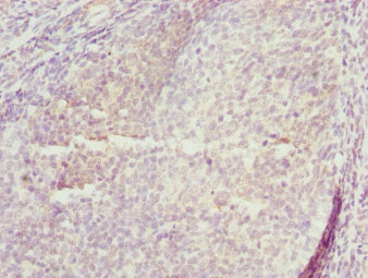 TRIM29 Antibody - Immunohistochemistry of paraffin-embedded human tonsil tissue at dilution 1:100